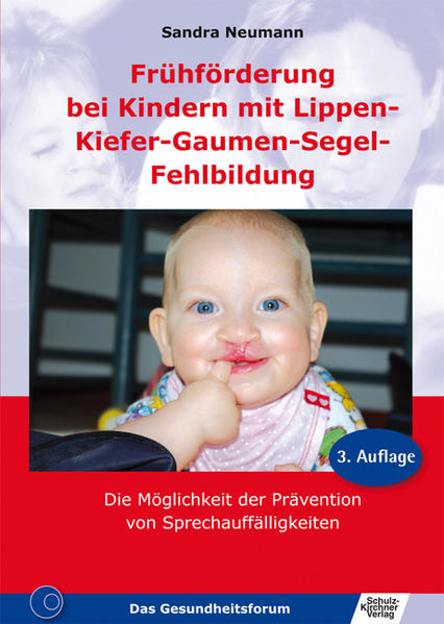 Bild zu Frühförderung bei Kindern mit Lippen-Kiefer-Gaumen-Segel-Fehlbildung (eBook) von Neumann, Sandra