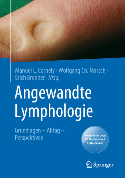 Bild zu Angewandte Lymphologie von Cornely, Manuel E. (Hrsg.) 