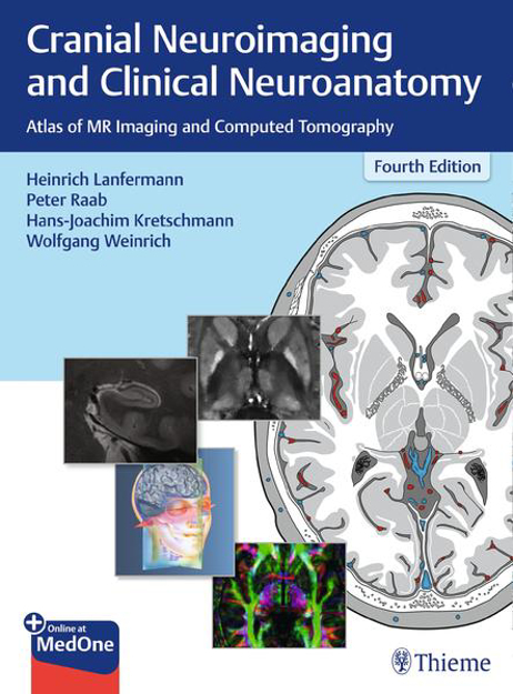 Bild zu Cranial Neuroimaging and Clinical Neuroanatomy von Lanfermann, Heinrich (Hrsg.) 