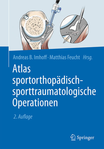 Bild zu Atlas sportorthopädisch-sporttraumatologische Operationen von Imhoff, Andreas B. (Hrsg.) 