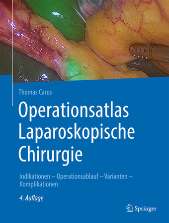 Bild zu Operationsatlas Laparoskopische Chirurgie von Carus, Thomas