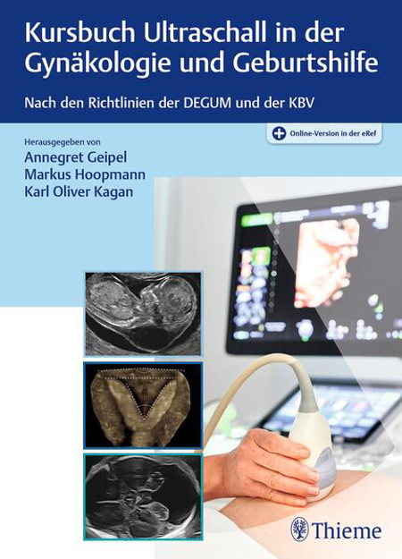 Bild zu Kursbuch Ultraschall in der Gynäkologie und Geburtshilfe (eBook) von Geipel, Annegret (Hrsg.) 