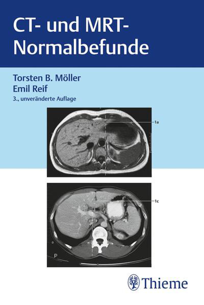 Bild zu CT und MRT Normalbefunde (eBook) von Möller, Torsten Bert 